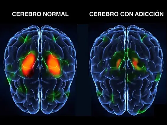 El alivio que atrapa